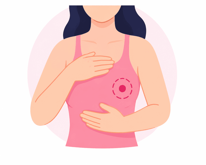 New Lump in the Breast